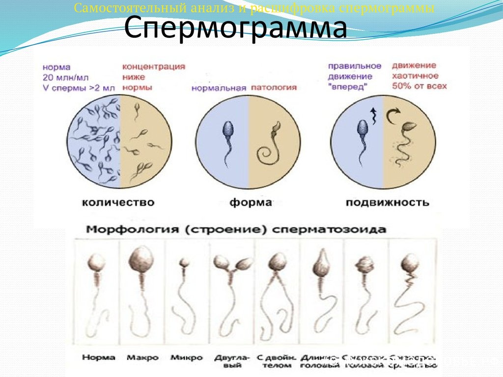 Виды сперматозоидов 